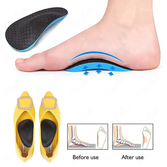 StepEase Orthopedic Arch Support Insoles — All-Day Pain Relief